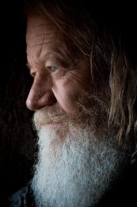 男のニキビ跡が顔全体にボコボコ、どう改善すればいい？